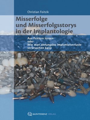 cover image of Misserfolge und Misserfolgsstorys in der Implantologie